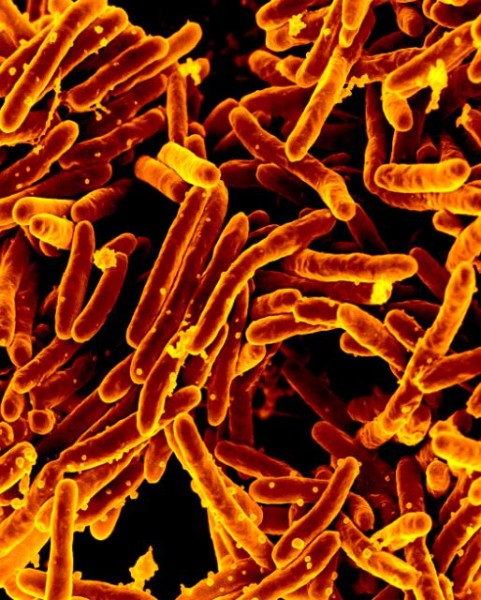 Mycobacterium Tuberculosis Bacteria, the cause of TB