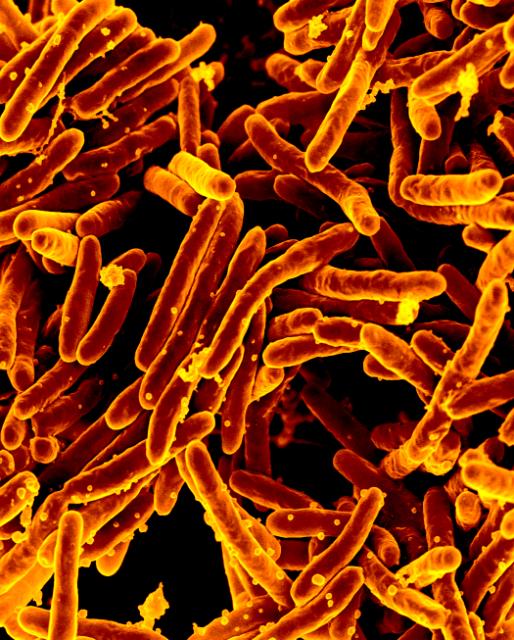 Scanning electron micrograph of mycobacterium tuberculosis bacteria